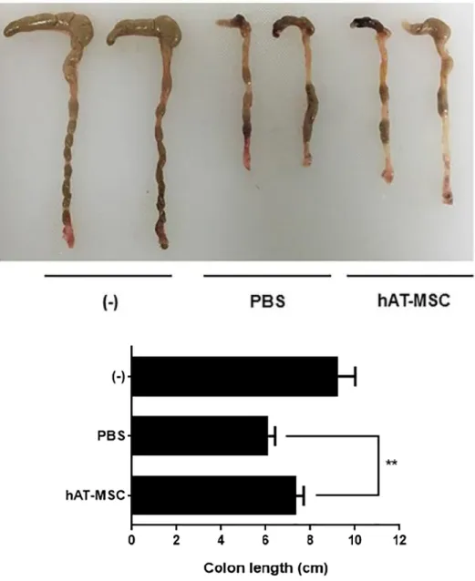 Figure  5.  Intraperitoneally  injected  hAT-MSCs  ameliorate  IBD.  DSS- DSS-induced colitis mice were infused hAT-MSCs or PBS (vehicle control) on day  1