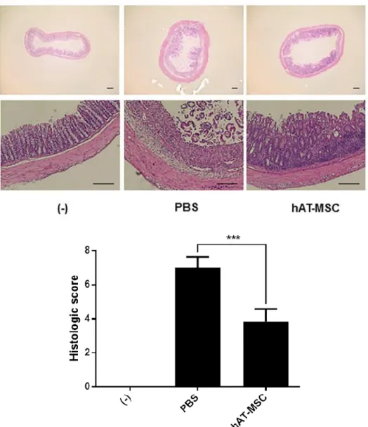 Figure  6.  Intraperitoneally  injected  hAT-MSCs  ameliorate  IBD.  DSS- DSS-induced colitis mice were infused hAT-MSCs or PBS (vehicle control) on day  1