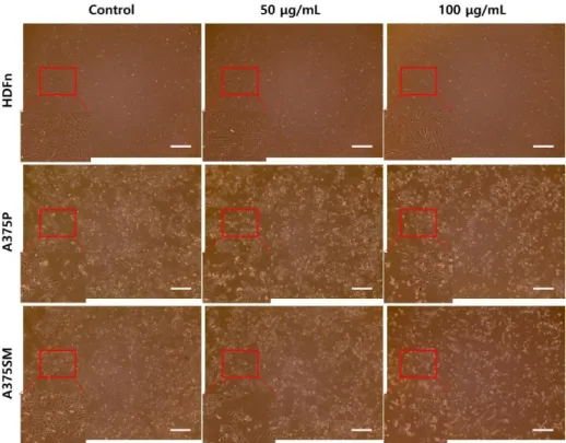 Figure 1. In vitro anti-cancer effect of LGG extract on A375P and A375SM. 
