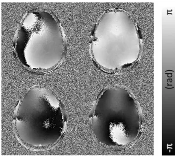 Figure  2.1  Phase  image  without  subtracting  phase  offsets  (at  TE=15.42 msec, coil 1, 4, 7, 10) 