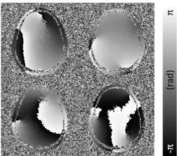 Figure 2.4 and 2.5 is phase offset map and corrected phase map by  MCPC-3D. The phase offsets are spatially varying and the corrected  phase map has good consistency among channels