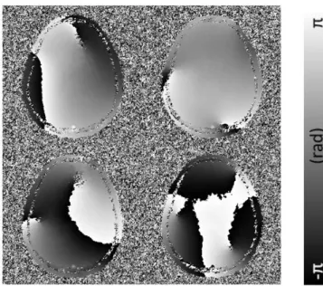 Figure 2.6 and 2.7 is phase offset map and corrected phase map by  MCPC-ME. MCPC-ME has similar phase offsets with MCPC-3D but  with less noise, and it shows better consistency among channels in  corrected phase maps