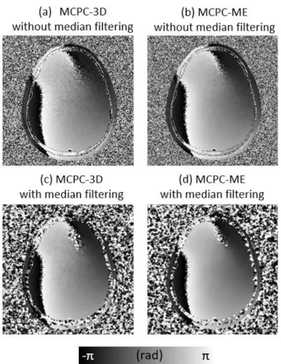 Figure  2.8  Representative  phase  offset  map  of  MCPC-3D  and  MCPC-ME, without and with median filtering (a) MCPC-3D without  median filtering, (b) ME without median filtering, (c)  MCPC-3D with median filtering, and (d) MCPC-ME with median filtering 