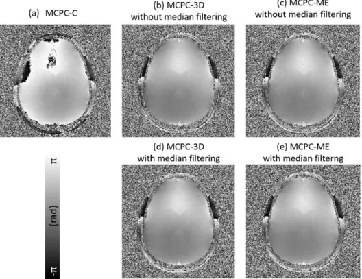 Figure 2.9 Combined phase image after subtraction of phase offsets  estimated by (a) MCPC-C, (b) MCPC-3D (no filtering), (c) 