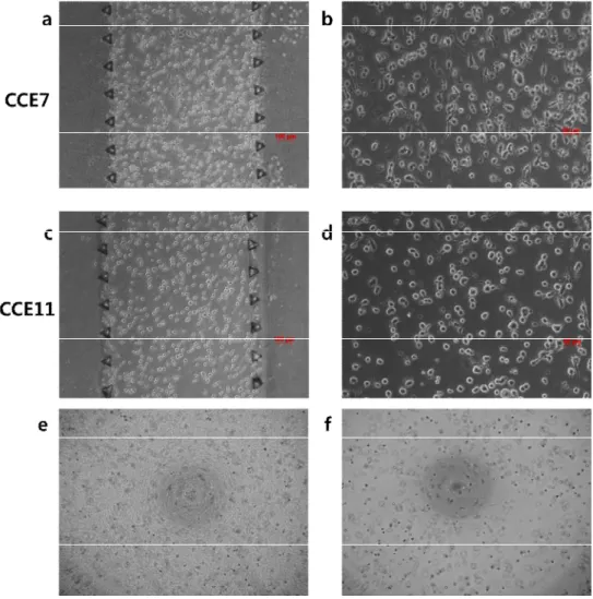 Figure  2.  Images  of  A549  cell  morphologies  at day1  (a)  In the  CCE7  gel  (5X) (b) In the CCE7 gel (10X) (c) In the CCE11 gel (5X) (d) In the CCE11  gel (10X) (e) morphology at day0 in CCE7 (10X) (e) morphology at day0 in  CCE11 (10X) 