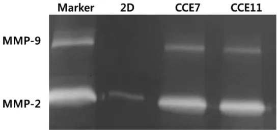 Figure 6. Results of zymography analysis 