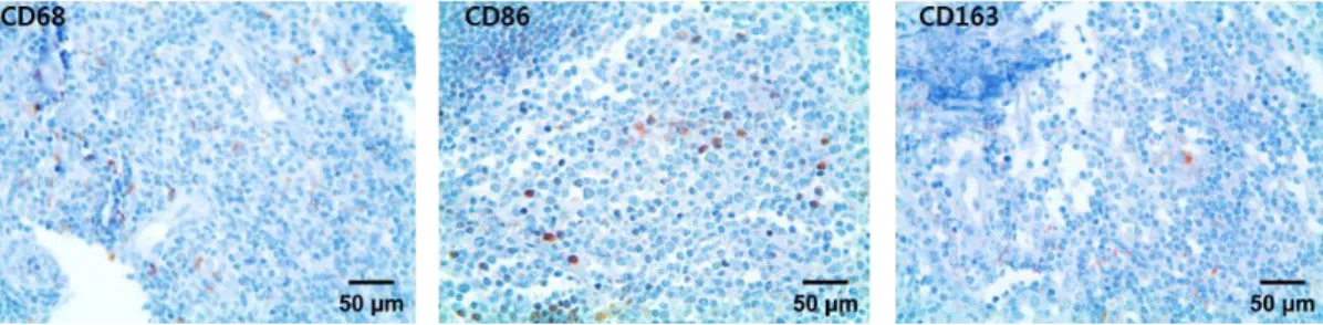 Figure  1.  Macrophage  recruitment  in  human  tonsil  FFPE  tissue.  Representative  CD68, CD86, and CD163 IHC images are shown as the positive controls for IHC  analyses
