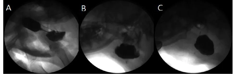 FIgure 5. Fluoroscopic images. In case of the first dog (A), mandibular gland and entire duct (white arrow) were  visualized although the gland was not fully filled with contrast medium