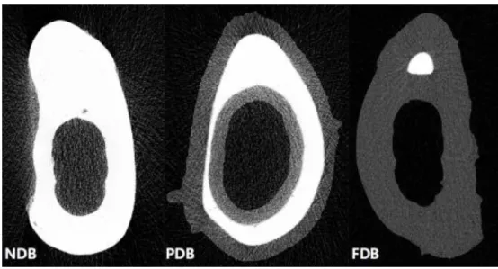 Fig.  2.  Micro-CT  images  showing  bone  demineralization  in  relation  to  HCl  exposure time (increasing from the left panel to the right)