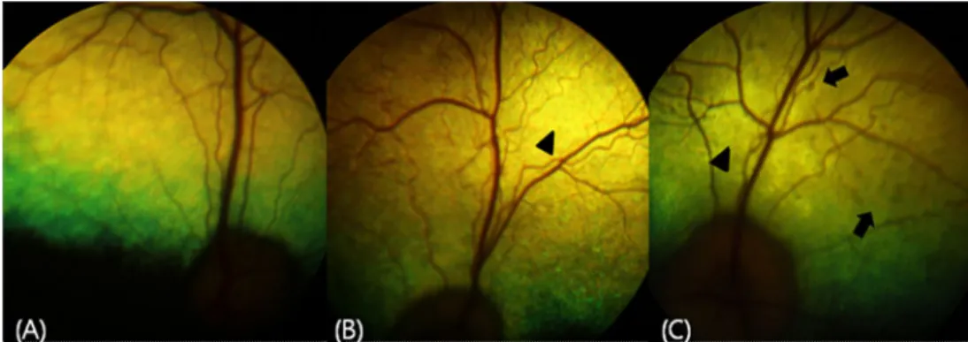 Fig. 1. Fundus examination on 28 days. (A) Fundus image of Group A showed no  significant abnormalities