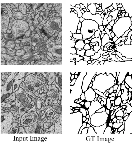 Figure 4.1: Example for dataset: Left is the ISBI 2012 EM (stack 1/30) and right is the Mouse Piriform Cortex EM dataset (stack2 1/170)