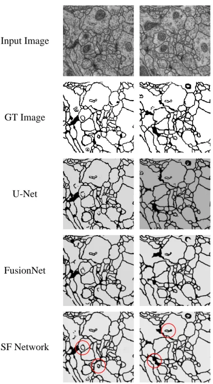Figure 4.2: Original, ground truth, and experimental result image in the ISBI