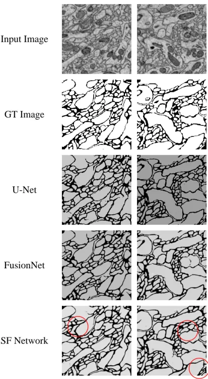 Figure 4.3: Original, ground truth, and experimental result image in the Mouse Piriform cortex EM dataset