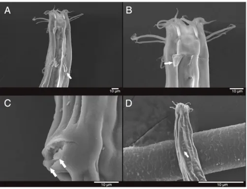 Figure 4 Scanning electron micrograph of Mesacanthion jejuensis sp. nov. (A) Male, head region, lat- lat-eral view, groups of cervical setae in doubles/trios with irregular latlat-eral and terminal processes