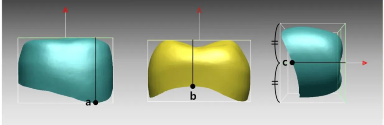 Fig. 5. Measurement of occlusocervical diameter. 