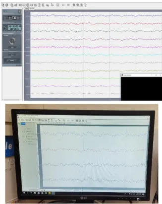 Fig. 2. Location of EMG and EEG sensor.