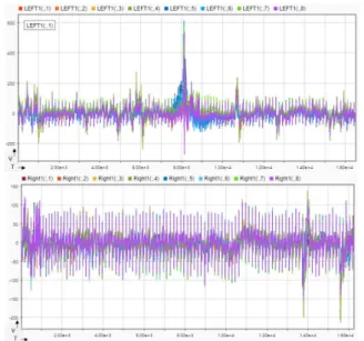 Fig. 6. 8-channel EEG output(Left(above), Right(below)).