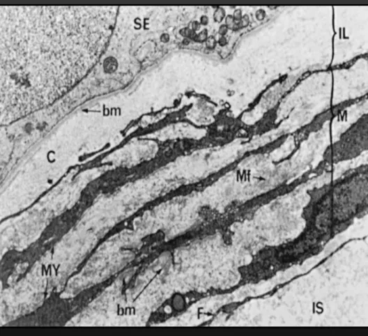 Figure 18-9  Low-power electron micrograph of the 