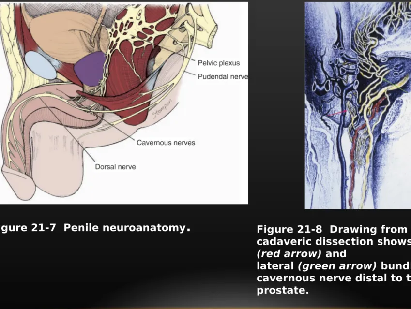 Figure 21-7  Penile neuroanatomy .  Figure 21-8  Drawing from a human  cadaveric dissection shows the medial  (red arrow) and