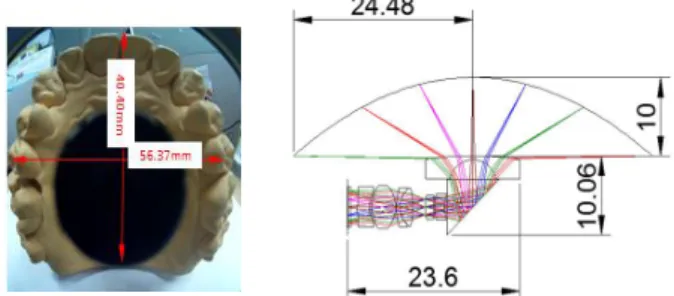 Fig. 1. Overall Configuration of small 360° Oral Scanner Lens Module.
