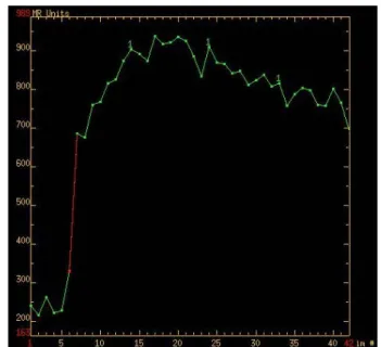 Fig. 1.  DSC Time-intensity curve and T2* relaxivity contrast. (a) 