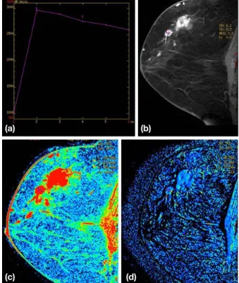 Fig. 7은 DCE 방법을 이용하여 촬영한 Fibroadenoma 유 방암  환자에서  얻은  혈류  Mapping 영상을 보여주고 있다 (Koo et al