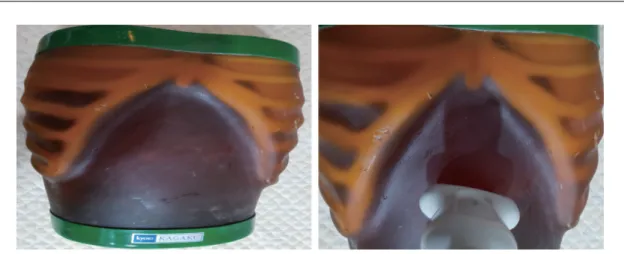Fig. 1. Phantom of abdominal ultrasound. 