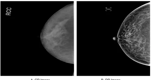 Fig. 3. Evaluation of Phantom image (CR and DR).