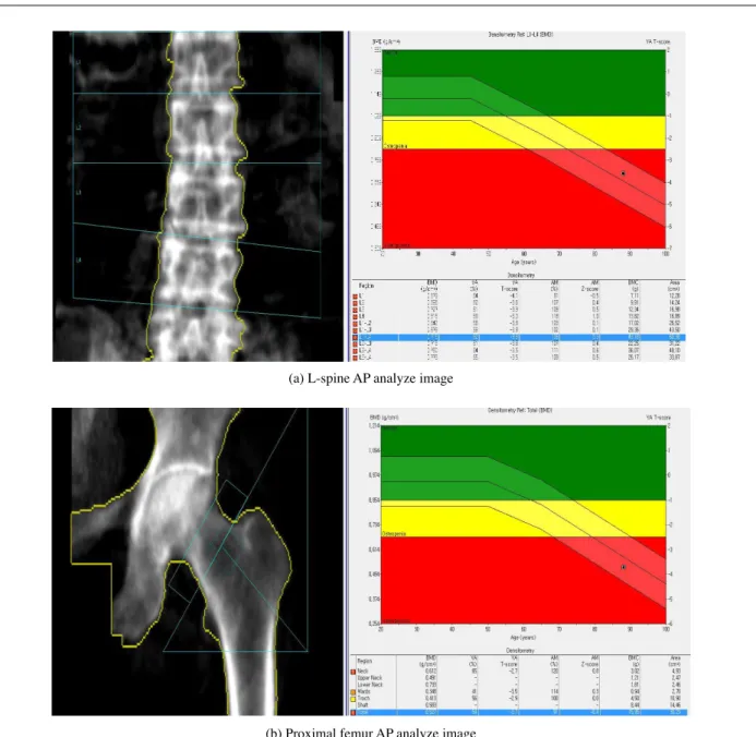 Fig. 5. Analyze.