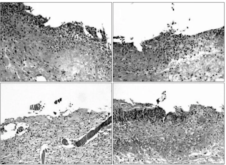 Fig. 6.  The  degree  of  infiltration  of  inflammatory  cells  on  the  7th  post-operative  day  (Hematoxylin-Eosin  stain,  ×100)