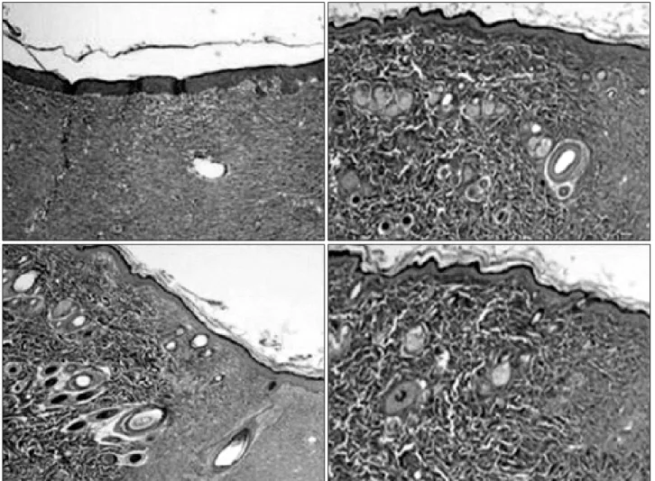 Fig. 7.  A  comparison  of  the  angiogenesis  on  the  14th  post-operative  day  (Masson's  trichrome  stain,  ×100)