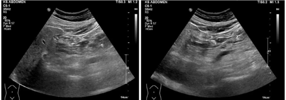 Fig. 6. Imaging of head of pancreas of B group (normal).