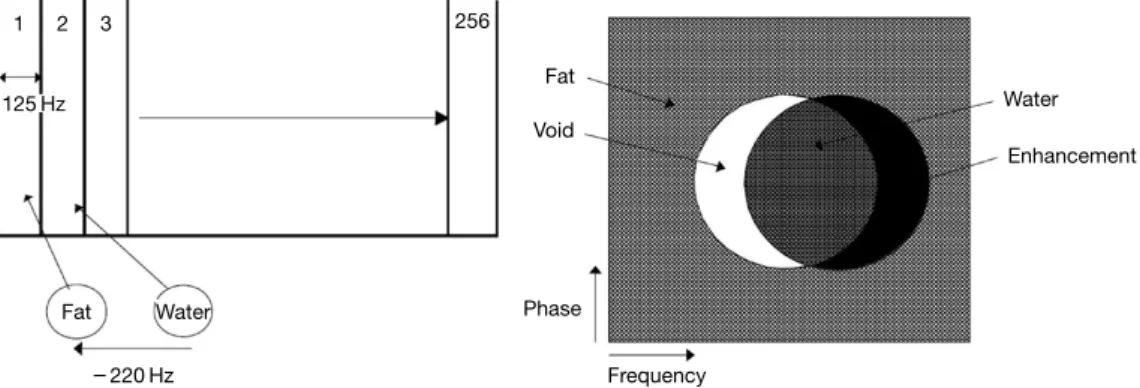 Fig. 1. Chemical shift artifacts caused by frequency differences on 1.5 T MRI units.