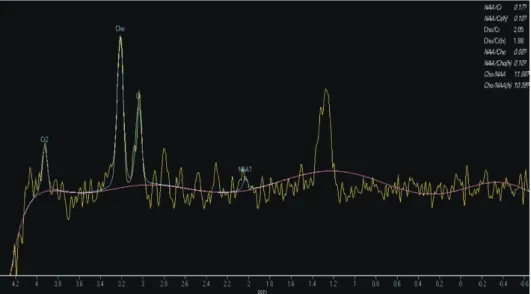 Fig. 7.   Elevated phenomenon up to about 3 ppm due to susceptibil­