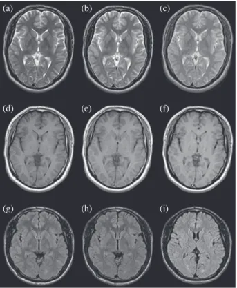 Fig. 1.   The images of Routine, RMS and SAR protocols are (a, 