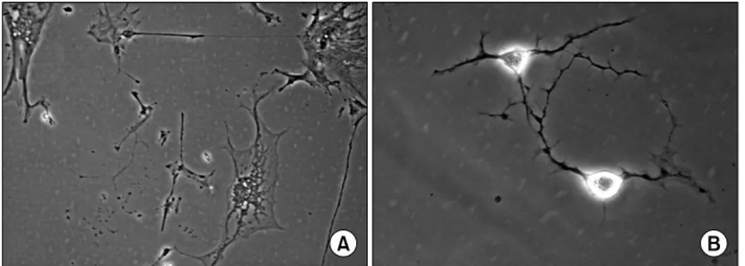 Fig. 3.  RT-PCR  analysis  of  human  adipose  tissue  derived  stem  cells  using  NSE  primers