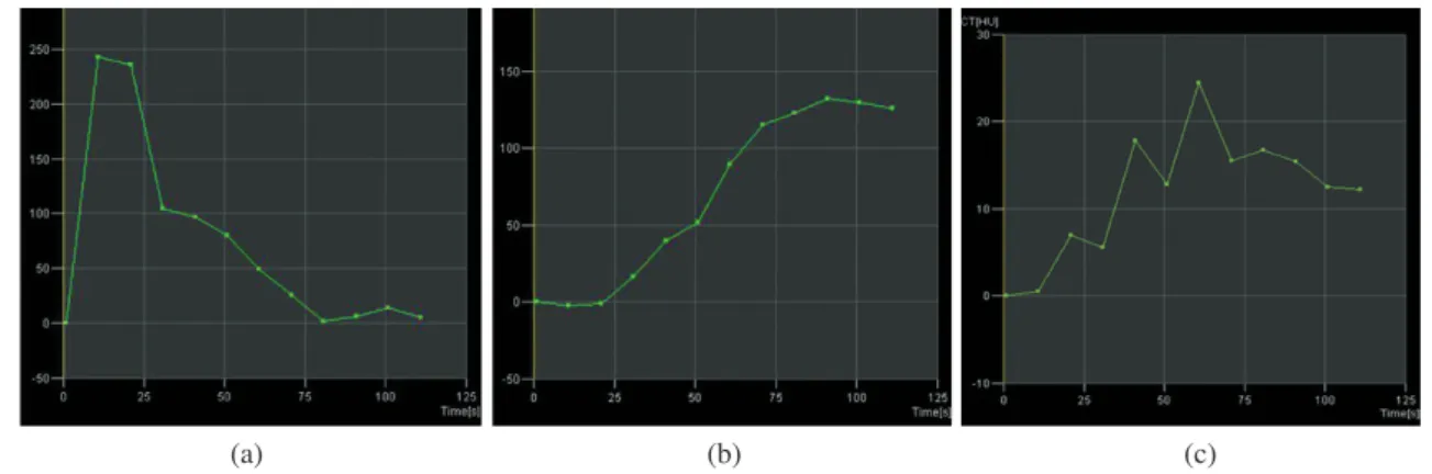 Fig. 2. Segmentation and vessels analysis of Leonardo workstation.Fig. 1. Slope of TDC (Time Density Curve) (a) Artery (b) Vein (c) Soft tissue.