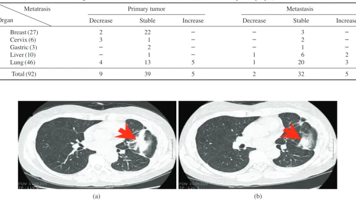 Table 3. Remedial value according to metastasis existence and nonexistence (unit: number of patient people) Metatrasis