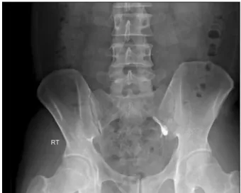 Fig. 8.  Twelve  months  after  the  operation,  the  range  of  motion  was  full.