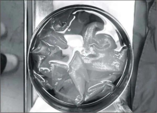 Fig.  3.  (A,  B,  C)  Immersion  process.  Note  the  color  change  of  pig  skin.