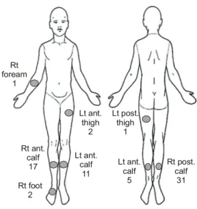 Fig.  3.  Locations  of  contact  burns.