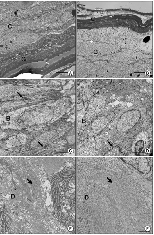 Fig. 4.  Histological  findings  of  con- con-trol  and  experimental  group  by   t-ransmission  electron  microscopy