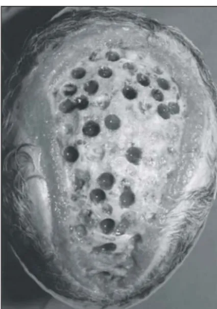 Fig.  1.  After  initial  debridement  of  the  exposed  skull  (2  hospital  day),  15×20  cm  size.