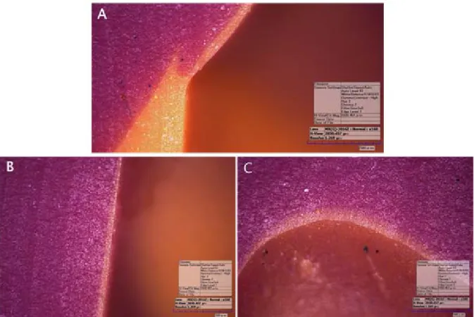 Figure  3.  Measured  cross-section  of  the  silicone  replication  using  a  enlarged  images  (160  X)  from  a  digital  electronic  microscope  (A:  marginal  gap,  B:  axial  wall  gap,  C:  occlusal  gap).