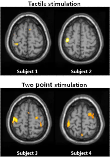Figure 1. The representative fMRI results showing cortical  activation during tactile stimulation and two point stimulationFWHM (full width of half maximum)을  갖는  Gaussian 