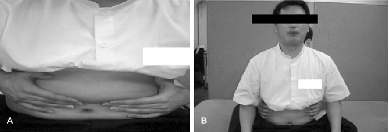 Figure 1. Combination of diaphragmatic resistive breathing and pursed‐lip breathing exercise (A:
