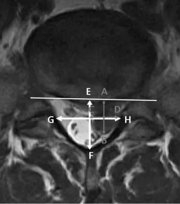 Figure 1. Schematic diagram of the MRI measurements. 