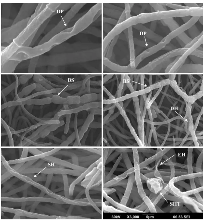Fig. 4. Crude antifungal metabolite induced morphological changes on A. alternata hyphae