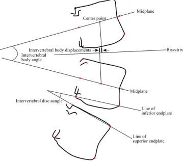 Figure 1. Measurement of intervertebral body angle,  intervertebral disc angle, and displacement