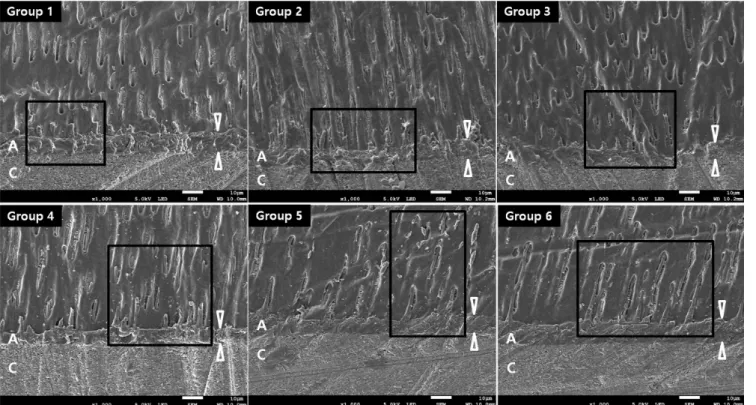 Figure 3. Micrographs of resin-dentin interface of experimental group observed under a SEM with a backscattered detector